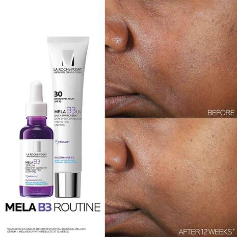 La Roche-Posay MELA B3 Serum 30ml – dark spot and discoloration correcting serum with Melasyl™ and 10% Niacinamide