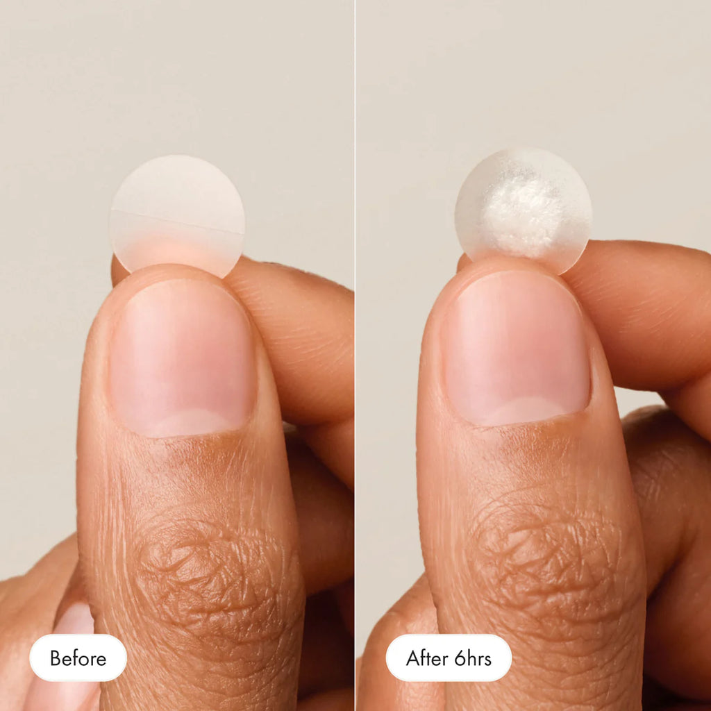 Hero Cosmetics Mighty Patch Original – hydrocolloid acne patches for fast pimple reduction and healing